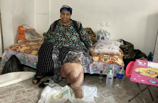 Önemsemedi bacakları bu hale geldi! Yaşlı kadın bir an önce tedavi olmak istiyor