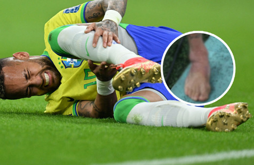 Neymar yürekleri ağza getirdi! Sakatlık sonrası ayak bileği bu hale geldi! Korkunç...