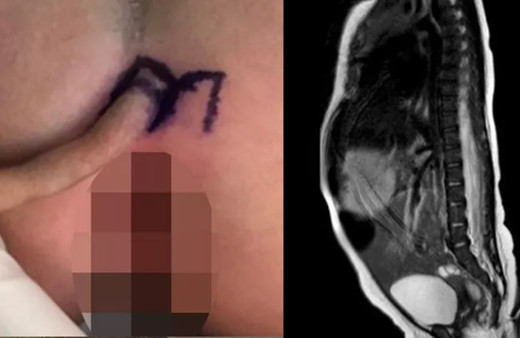 Milyonda bir görünüyor! Doktorlar bile donup kaldı! Böyle bir şey nasıl olur?