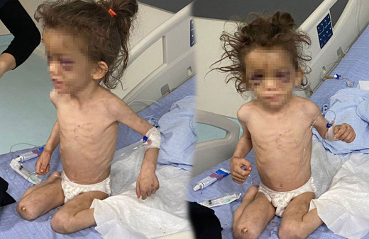 Gaziantep'te cani anne 5 yaşındaki çocuğunu günlerce aç bırakıp işkence etti