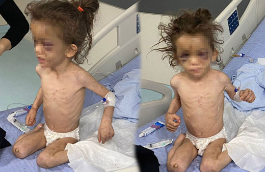 4 yaşındaki kızını aç bırakıp 3 gün boyunca işkence etti! Cani anne bakın neden yapmış!