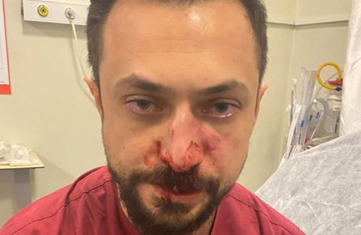 Acil Servis'te 'önce benim hastama bak' kavgası! Hasta yakını doktorun burnunu kırdı