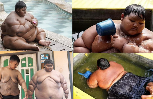 Dünyanın en şişman çocuğuydu herkes ölmesini beklerken son hali inanılmaz!