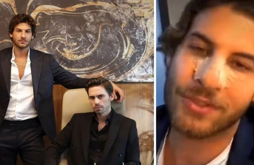 Mustafa Mert Koç asıl gerçeği açıkladı: Burun estetiği iddialarına videolu cevap!