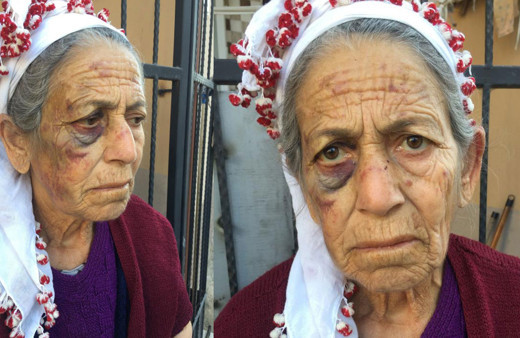 Bayılana kadar dövüldü, altınları çalındı! Kanser hastası kadın dehşet anlarını anlattı: "Kapıyı açar açmaz..."