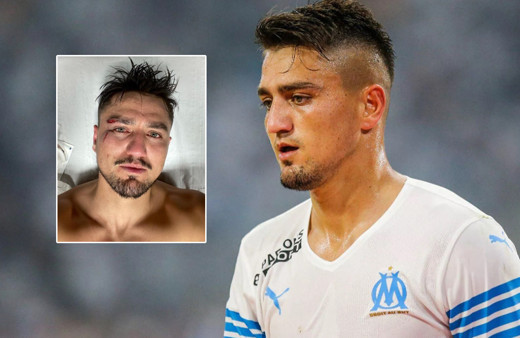 Cengiz Ünder yürekleri ağza getirdi! Maç sonu paylaştı, yüzü bu hale geldi