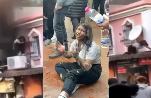 Nazilli’den acı haber! Patlamadan kendi imkanlarıyla böyle kurtulmuştu, genç kız hayatını kaybetti