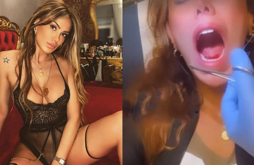 Ceyda Ersoy, öpüşürken kopan dilini diktirdi! O anları sosyal medyadan paylaştı