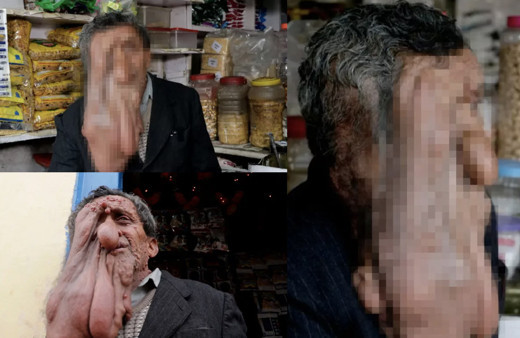 Yüzü günden güne eriyor! Öyle bir hastalığa yakalandığı ki...