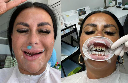 Antalya'ya diş estetiği yaptırmaya geldiler hayatları karardı! Ağızlarına koyamıyorlar...