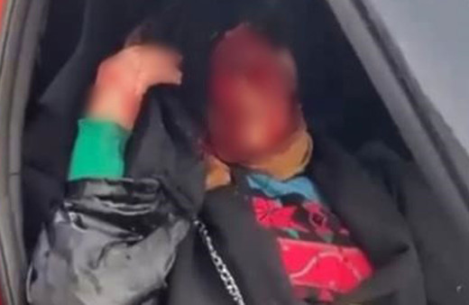 Dini nikahlı eşi sokak ortasında bıçakladı yüzü paramparça olan kadın konuştu