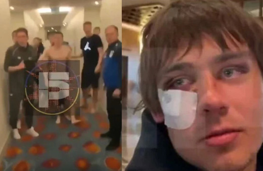 Antalya'da Rus ve Ukraynalı futbolcular tekme tokat kavga etti: Kemirleri kırıldı!