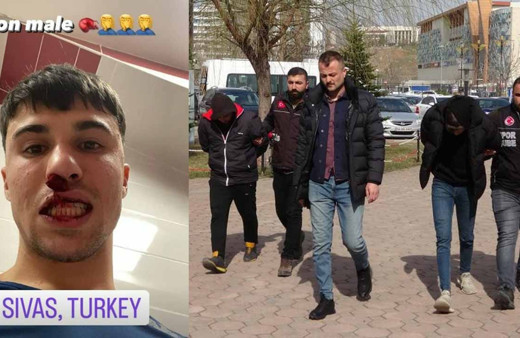 Fiorentinalı futbolcunun burnu kırıldı! Sahaya giren Sivassporlu taraftarlar tutuklandı