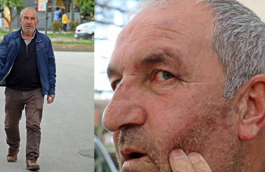 Kulak zarı patlayana kadar dayak diyen adam: "Bu değilmiş" deyip gittiler
