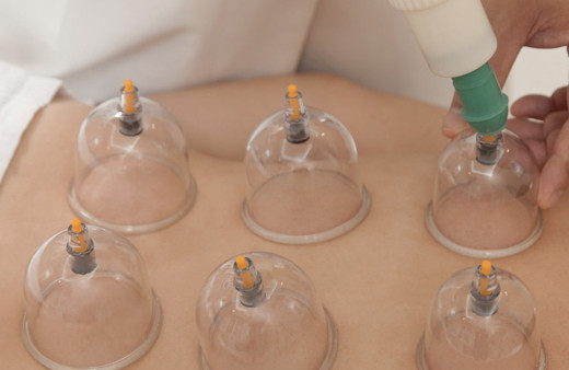 Hacamat hangi günler yapılır? Nisan ayı hacamat yaptırma takvimi