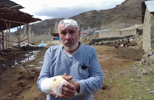 Kurt saldırısında yaralı kurtuldu yaşadığı dehşeti anlattı