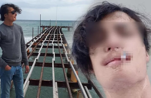 İstanbul'da akılalmaz olay beynine yerleştirmişler! Ameliyata giren genç adam kabusa uyandı