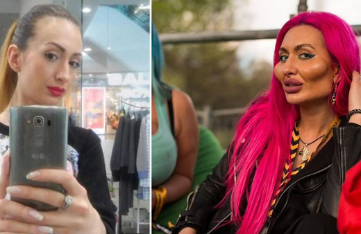 Doktorlar uyardı o vazgeçmiyor! Dünya'da tek olmak istiyor: Ameliyat için yeniden Türkiye'ye geldi!