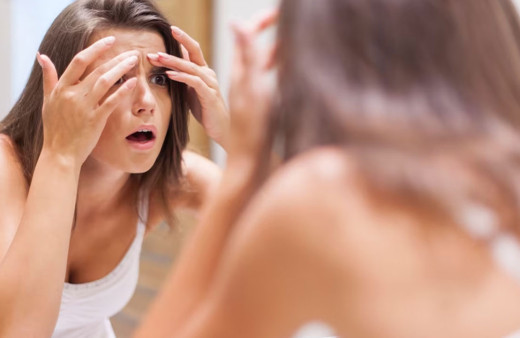 sivilce ve aknelere karşı arı zehri ve propolis