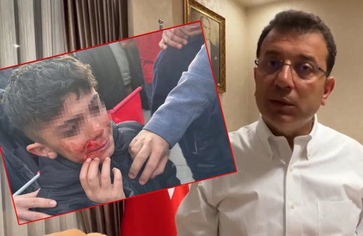Ekrem İmamoğlu'ndan saldırı açıklaması! Fotoğrafı gösterdi: 'Şu çocuğu polis koruyamadı'