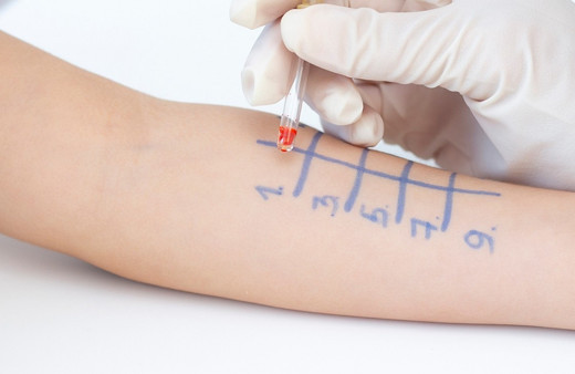 Alerji testleri, alerjik rinitin tedavi yöntemini belirliyor