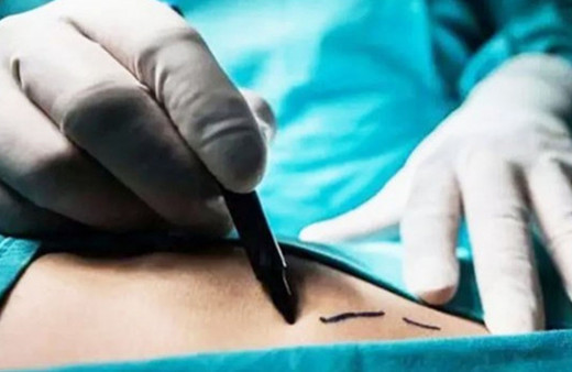 İstanbul'da organ ticareti operasyonu