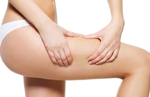 Yaz yaklaşıyor, selülitten kurtulmak isteyenler dikkat etmeli!