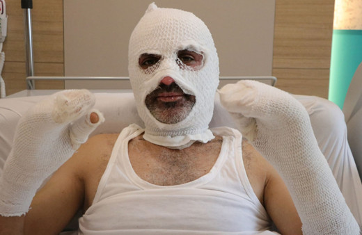 Grip yüzünden kokuyu almadı ve çakmağı çaktı!