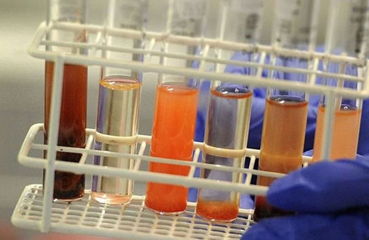 Diyarbakır'da okulda patlama oldu! Öğrenciler ve öğretmen yaralandı