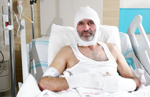 Gaz kokusunu alamadığı için yanan adam uyardı: Ben yandım, siz yanmayın!