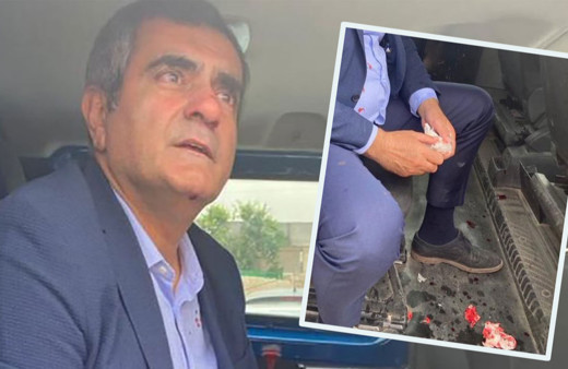 CHP'li Özgür Özel: Şanlıurfa'da milletvekilimiz Ali Şeker ve müşahitlerimiz dövüldü! Kanlı fotoğraf