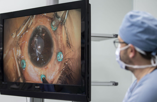Göz hekimleri canlı yayında 70 göz ameliyatına imza atacak