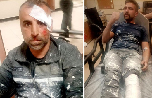 Adıyaman'da sokak köpekleri iki vatandaşı yaraladı