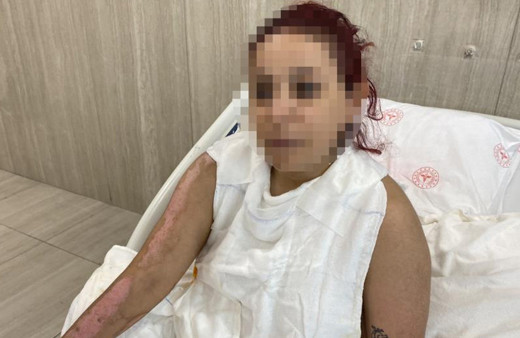 Barda dehşeti yaşayan genç kız içler acısı halde! "Sıcak su kaynatırken bile korkuyorum"