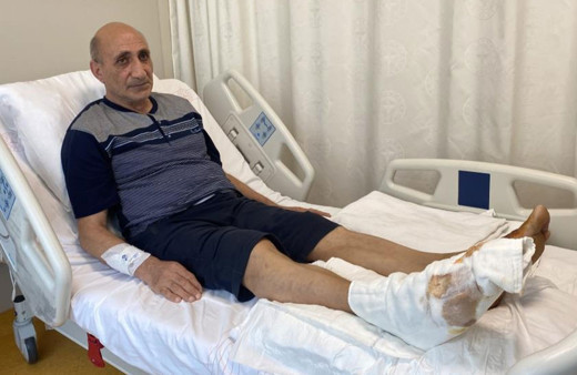 Leke sökücü yüzünden neredeyse ayağından oluyordu!