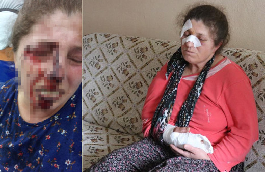 Bolu'da 4 çocuk annesi acımasızca darp edildi