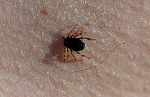 Havaların ısınmasıyla kene vakaları ortaya çıkmaya başladı!