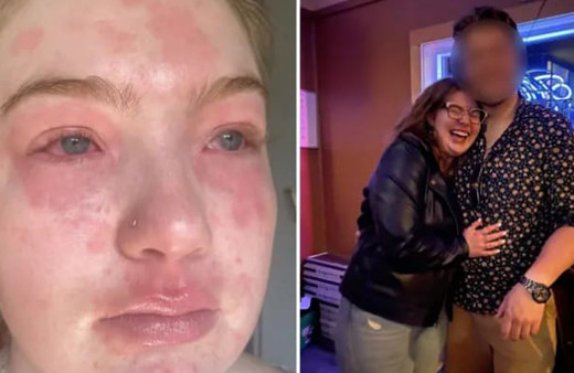 Erkek arkadaşınıza alerjiniz olabilir! Genç kadının ilginç hikayesi: Hastanelik bile oldu!