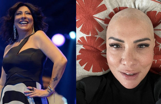 Işın Karaca'ya ne oldu, saçları neden döküldü? Kanser sanıldı hastalığı belli oldu