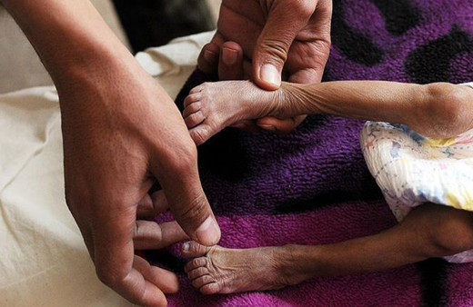 Nijerya'da iki ayda 80 kişi difteriden hayatını kaybetti!