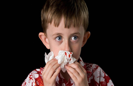 Yaz aylarının korkulu rüyası burun kanamasına aman dikkat! Nedeni bambaşka olabilir