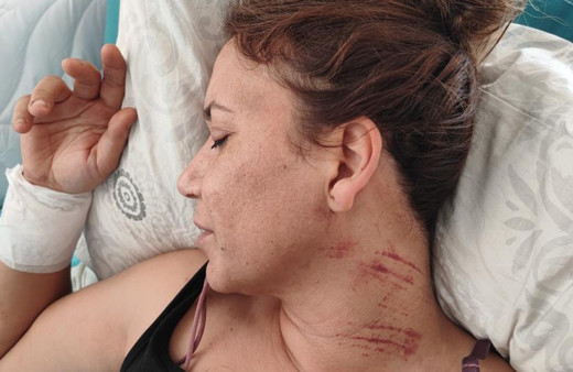 Emlakçı kadın iş yerinde vuruldu, kanlar içinde kaldı: Silah tutukluk yapmasa belki de ölmüştüm