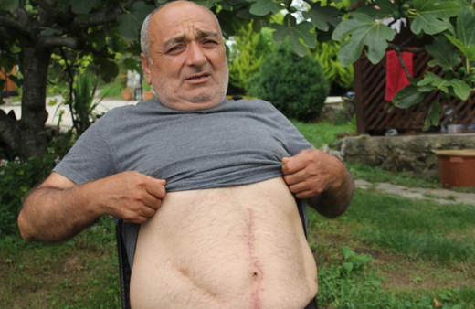 Ameliyat oldu ağrıları bir türlü geçmedi kanser bile zannedildi gerçeği 18 yıl sonra öğrendi