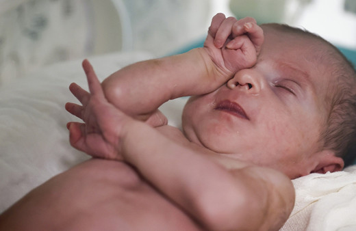 Kıbrıslı Nehir bebek "25 binde 1" görülen hastalığından Türkiye'de kurtuldu