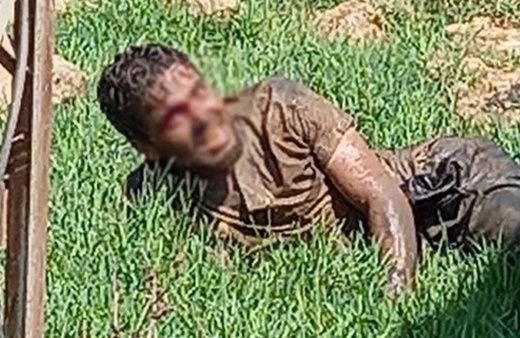 Şanlıurfa'da büyük panik! Kuduz hastası hastaneden kaçtı olanlar oldu