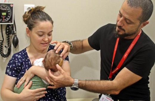 Antalya'da pusetten düşüp kafatası kırılan 1 aylık bebek iyileşti!