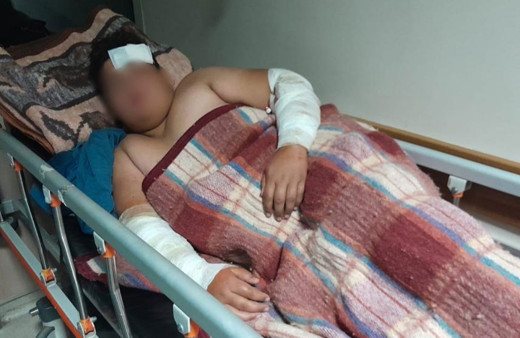 Konya'da köpeklerin kovaladığı çocuk bisikletten düşüp yaralandı!