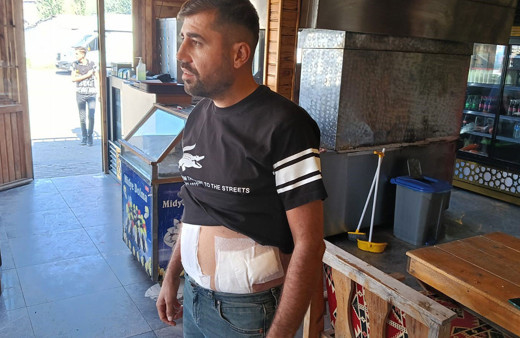 İnsanlık ölmedi dedirten davranış! Arabayla kadını takip edip laf atan tacizcilere tepki gösterdi karnından bıçaklandı