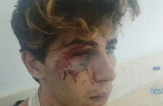 Sevgilisinden çıplak fotoğraf isteyip kendisine silahla işkence ettiler! Sosyal medyada yayınladılar