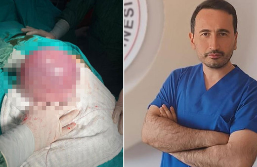 54 yaşındaki hastanın karnından dev tümör çıkarıldı!